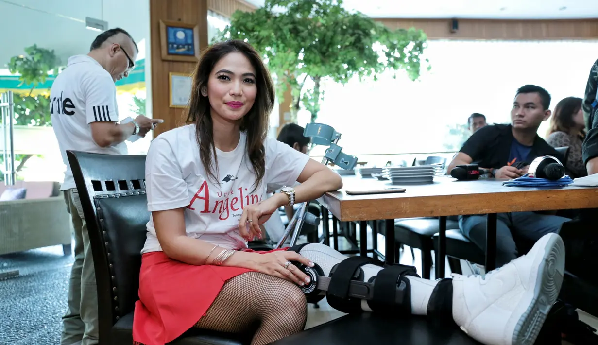 "Kaki jatuh di lokasi syuting, jatuh ke selokan dan bagian dalam lututnya itu ada yang putus. Sekarang udah disambung, jadi dua minggu nggak boleh ditekuk, sekarang udah sekitar tiga minggu diperban gini," ungkap Kinaryosih. (Adrian Putra/Bintang.com)