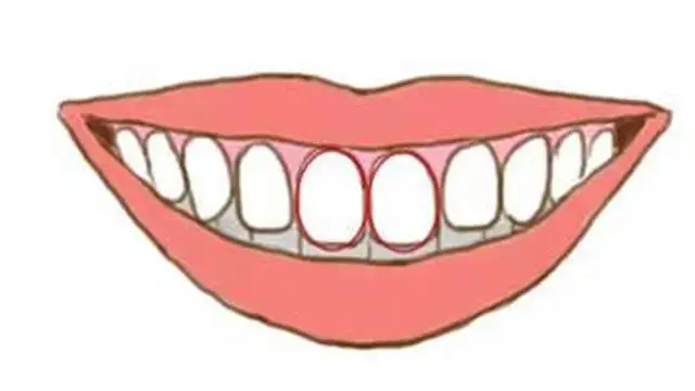 Ilustrasi gigi depan