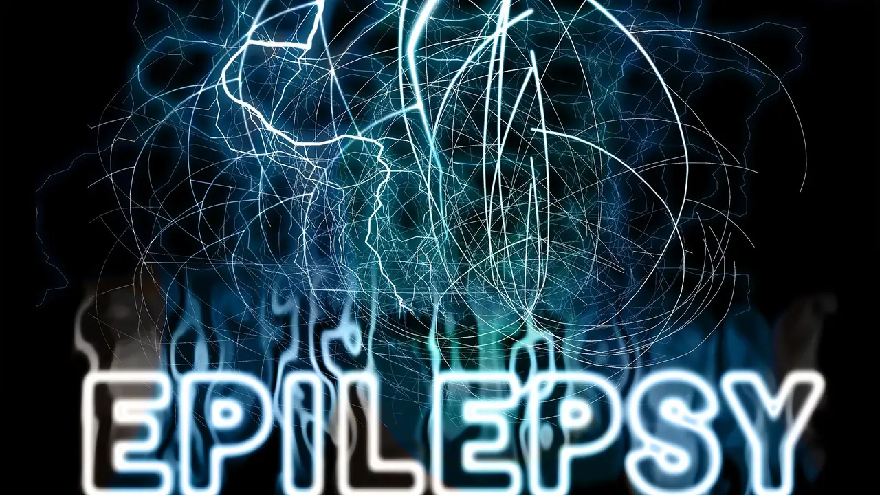 Epilepsi