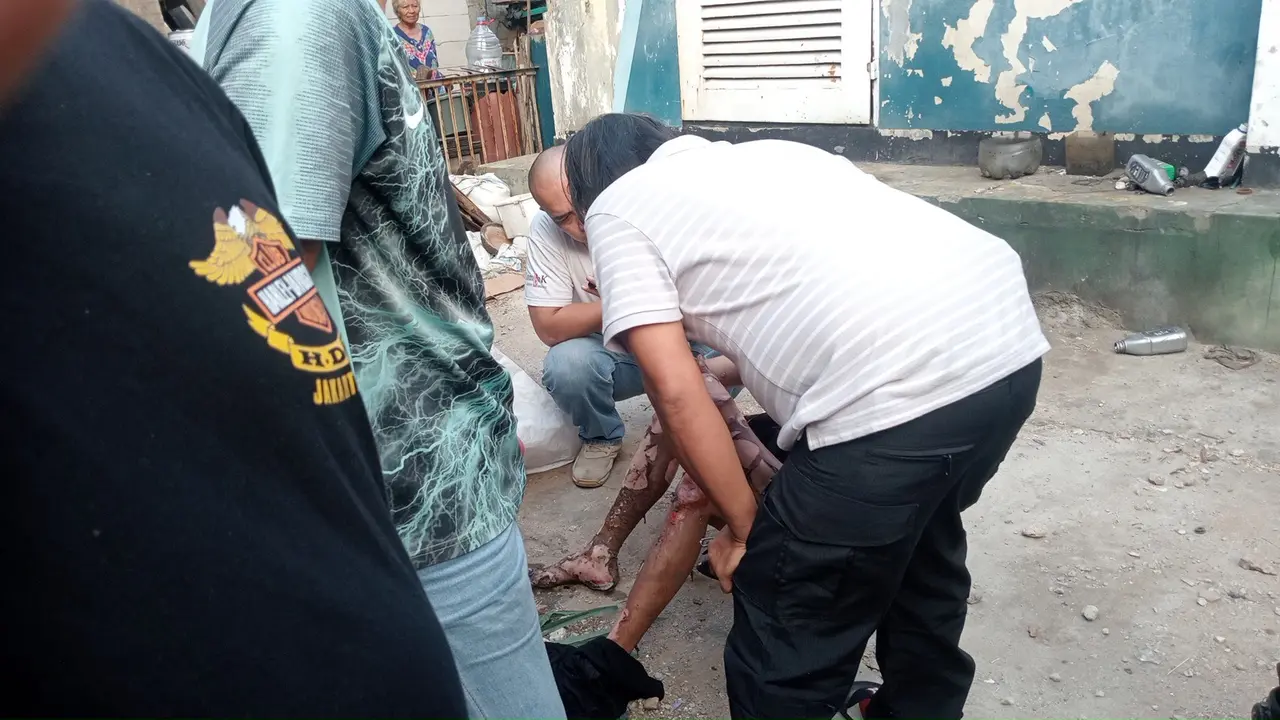 Diduga curi kabel, pria tersengat listrik hingga luka bakar 70 persen.