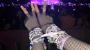 <p>Lisa memamerkan gelangnya di foto pertama dari carousel sambil menunjukkan tanda peace. Dia menikmati konser bersama teman-temannya. (Foto: Instagram/ lalalalisa_m)</p>
