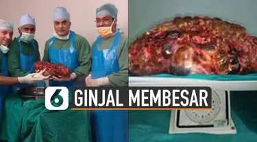 Dokter di India berhasil mengangkat ginjal seberat 7,4 kilogram. Pasien mengalami kelainan hingga ukuran ginjalnya membesar.