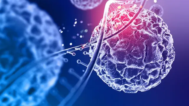 Jenis Sarkoma Jaringan Lunak (SJL)