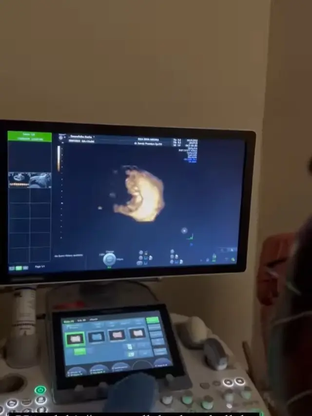 Kesha Ratuliu Hamil Anak Kedua