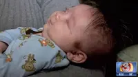 Bayi Ini Lahir Tanpa Bola Mata