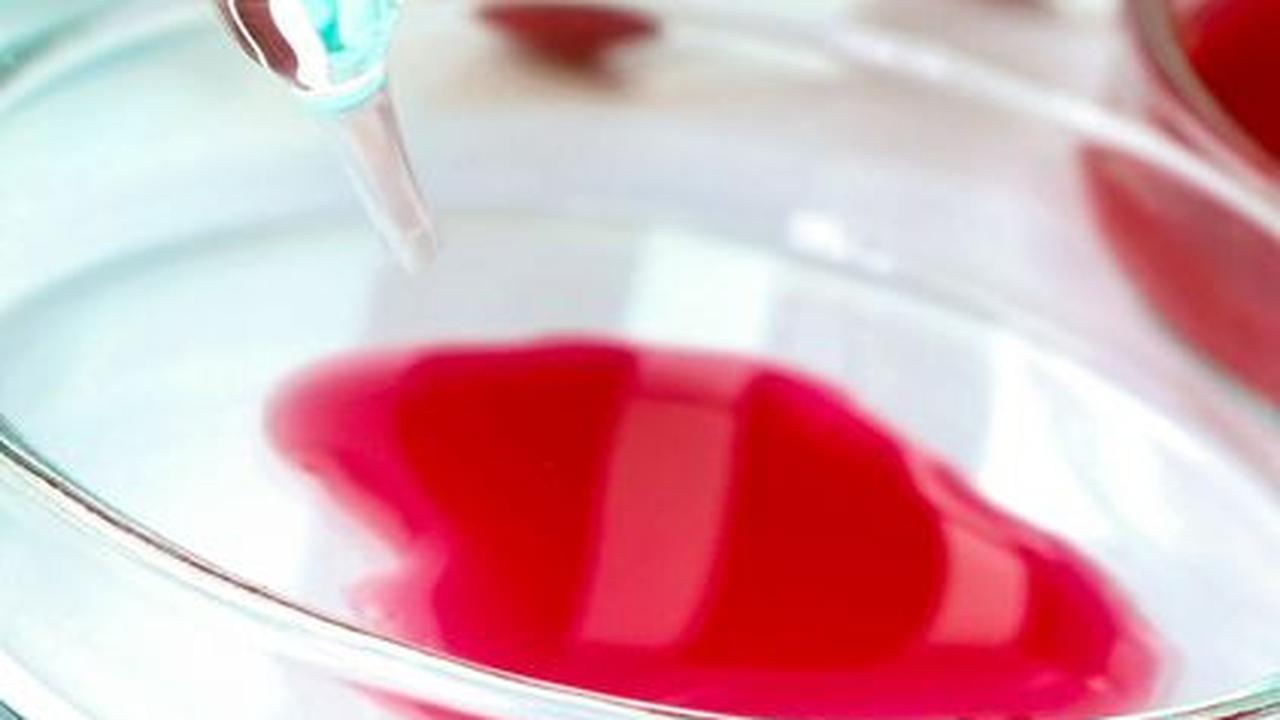 6 Jenis Tes DNA Beserta Manfaat & Cara Pengambilan Sampel, Bisa Deteksi Berbagai Penyakit Genetik