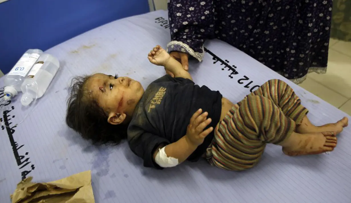 Seorang bocah terluka dan dilarikan ke rumah sakit al-Najar di Rafah, di Jalur Gaza selatan, pada tanggal 9 Juli 2014. Puluhan bocah lainnya luka berat dan meninggal dunia (AFP PHOTO/SAID KHATIB)