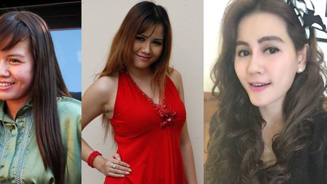 Nita Talia Tak Malu Akui Lakukan Operasi Plastik Demi Pertahankan Rumah Tangga Lifestyle Fimela Com