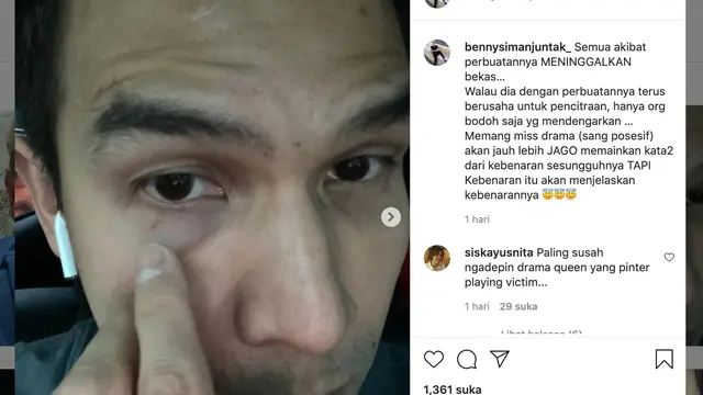 Unggahan Benny Simanjuntak tentang Jonathan Frizzy. (Foto: Instagram @bennysimanjuntak_)