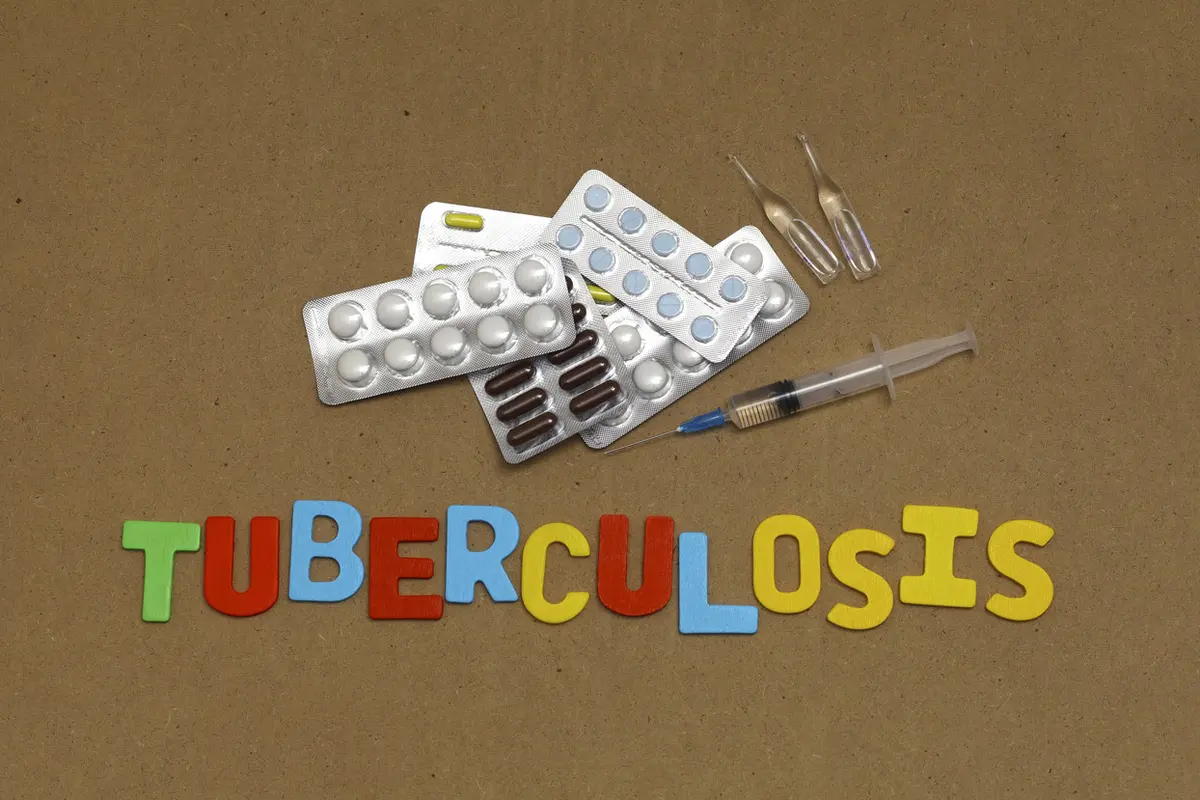 Ilustrasi TB - TBC (iStockphoto)