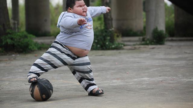 Cara Mengatasi Obesitas pada Anak