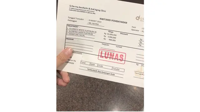 Biaya Fantastis, Begini Struk Perawatan Revina VT Mantan Younglexx Bikin Sobat Missquen Terguncang