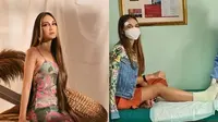 Alami Patah Tulang Metatarsal, Ini 6 Potret Kondisi Terbaru Luna Maya