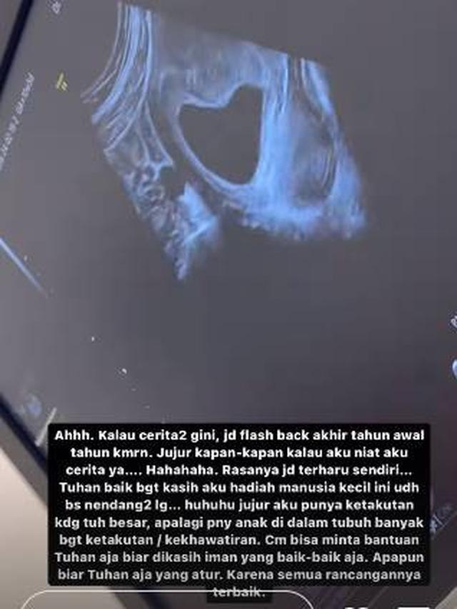 7 Potret Jonatan Christie dan Shanju Umumkan Hamil Anak Pertama, Penuh Kebahagiaan