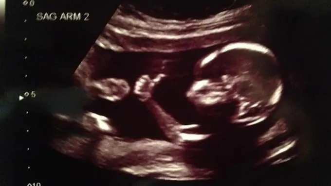 Photo copyright Reddit/meancloth