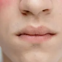 Selama berpuasa tubuh cenderung mengalami penurunan asupan cairan yang dapat berdampak pada kondisi kulit (Sumber: Pexels.com)