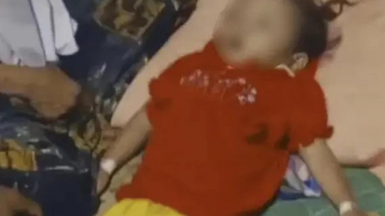 Penjelasan Lengkap Dokter yang Pertama Kali Tangani Raya, Bocah Meninggal karena Tubuh Penuh Cacing