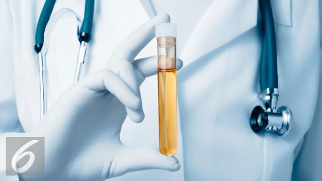 Ilustrasi Foto Air Seni atau Urine