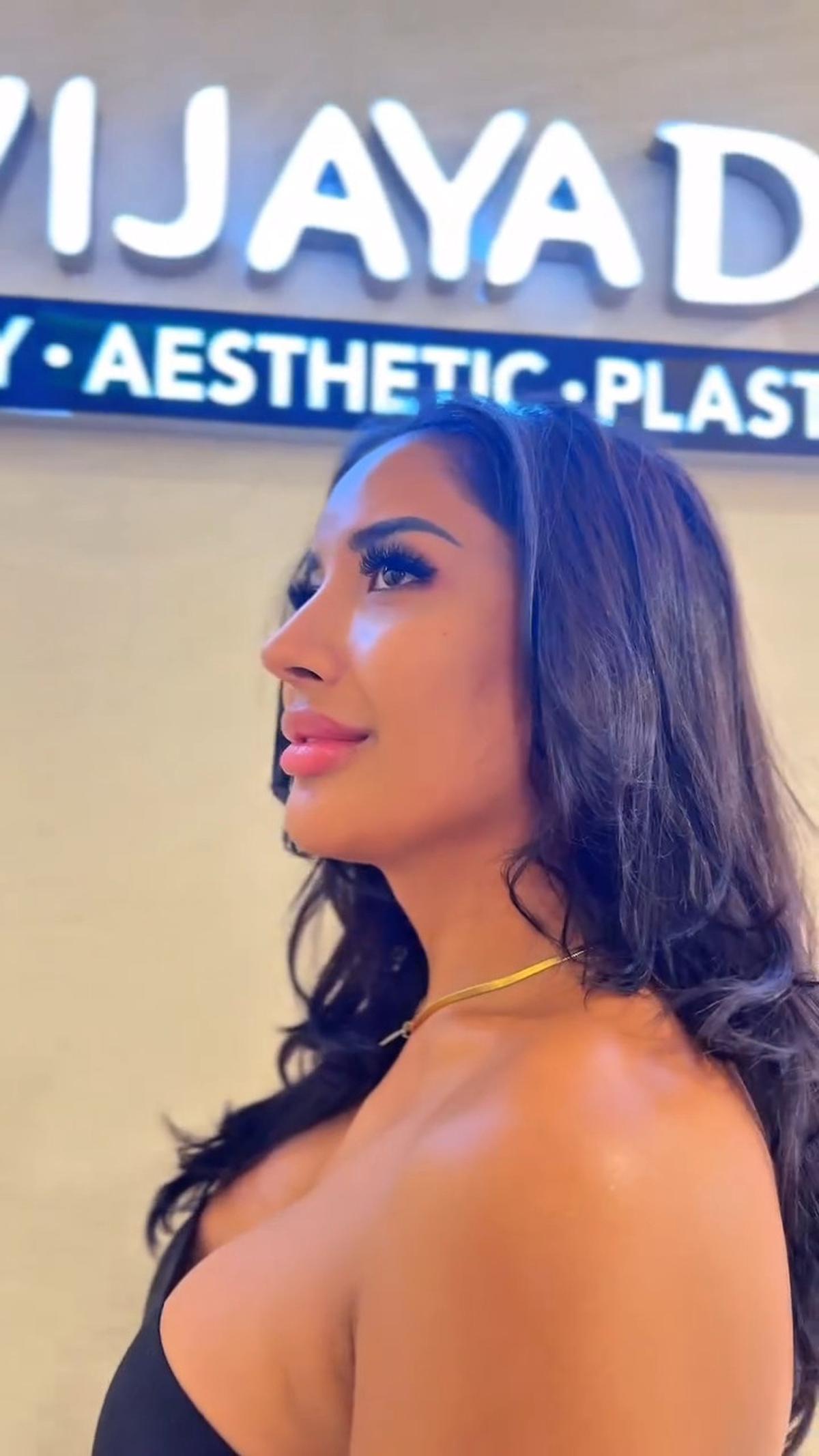 Millen Cyrus Mau Rombak Hidung Lagi, Netizen: Udah Cantik Mau Diapain Lagi?