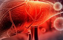 Cara Mencegah Hepatitis, Perhatikan Kebersihan Diri