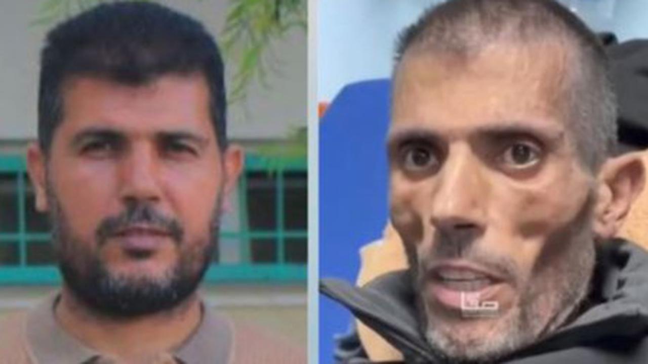 Tawanan Palestina Ini Kurus Kering Setelah Keluar dari Penjara Israel, "Saya Dipasung dan Mata Saya Ditutup Selama 45 Hari"