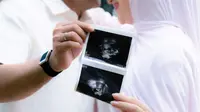 Irish Bella Umumkan Kehamilan Pertama dengan Haldy Sabri, Tampil Modest Bernuansa Pastel