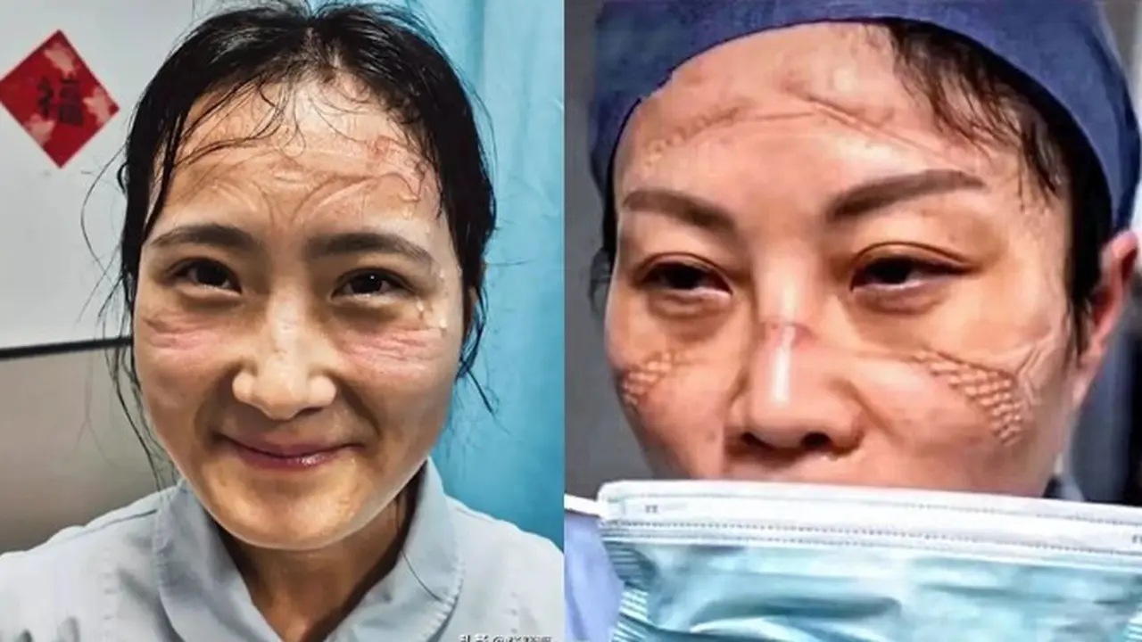6 Potret Wajah Suster Rawat Pasien Virus Corona Ini Bikin Haru