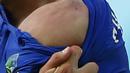 Bekas luka di bahu Giorgio Chiellini pada pertandingan penyisihan Piala Dunia Grup D 2014 di Dunas, Brasil, Selasa (24/6/14). (REUTERS/Tony Gentile)