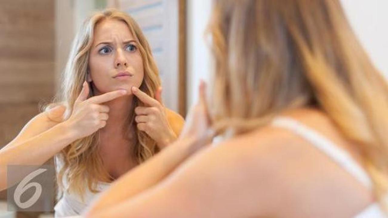 5 Hal yang Membuat Jerawat Semakin Parah
