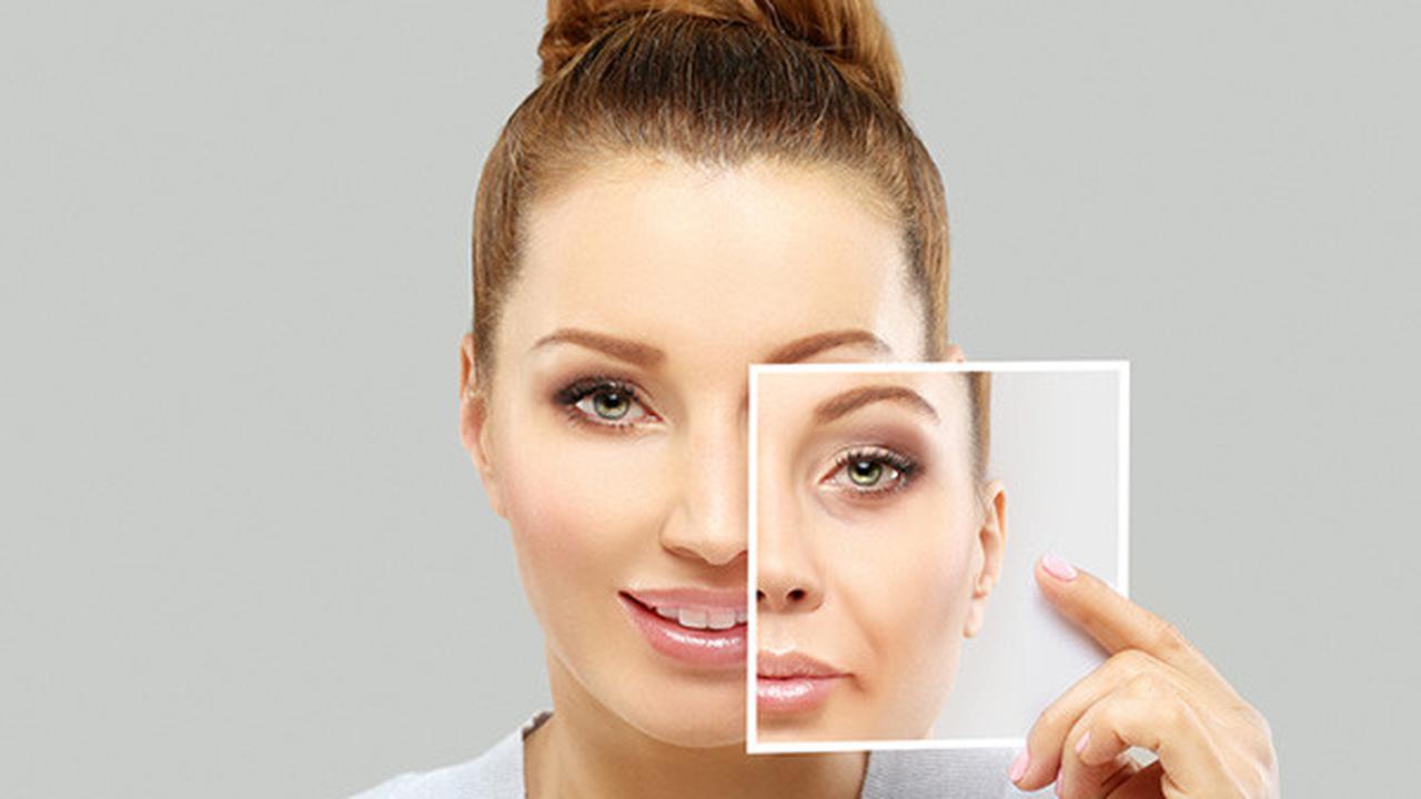 ilustrasi kerutan di wajah | Pexels