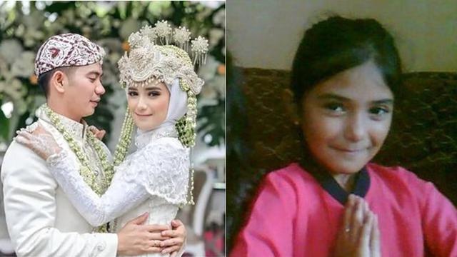 6 Foto Masa Kecil Hingga Remaja Nadya Mustika Disebut Mirip Orang Bangladesh Hot Liputan6 Com