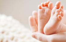 Bikin Geger Bayi di India Lahir dengan 25 Jari, Ternyata Idap Kelainan ini