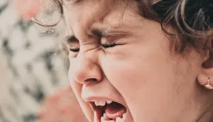 Kenali Ciri-Ciri Karies Gigi pada Anak, Jangan Tunggu Parah