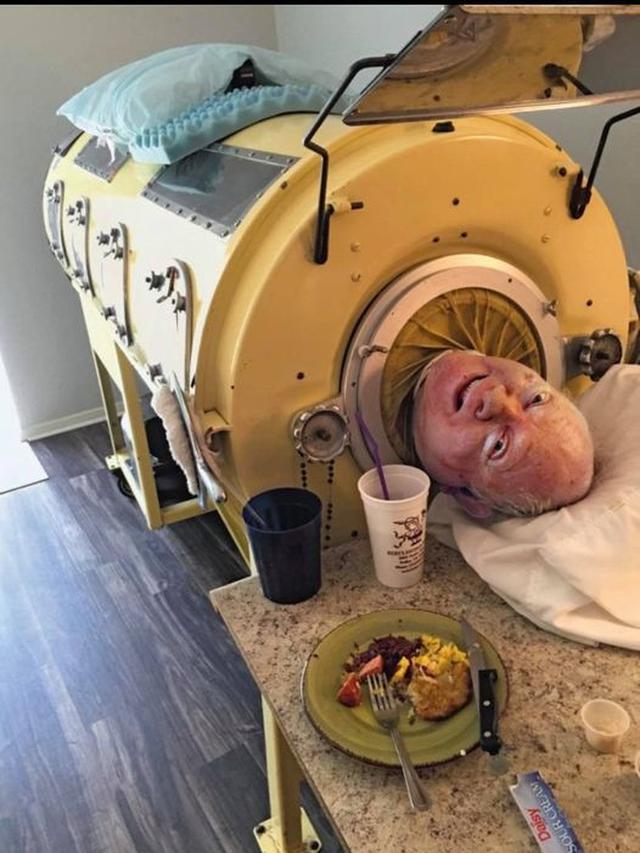 Kisah Polio Paul, 70 Tahun Bertahan Hidup Dengan Paru-paru Besi