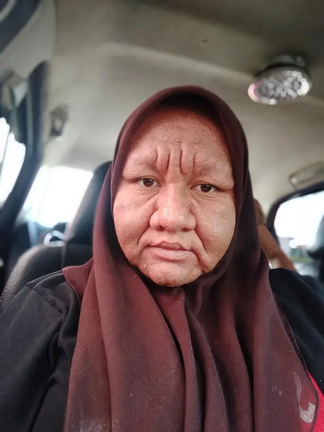 Viral, Wanita Ini Alami Perubahan Wajah Seperti Nenek-nenek Saat Hamil