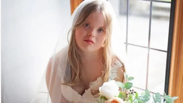 Cerita Wanita Down Syndrome Yang Sukses Dikontrak Jadi Model Lifestyle 