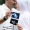 Potret Irish Bella Bagikan Maternity Shoot Bareng Haldy Sabri, Tunjukkan Hasil USG