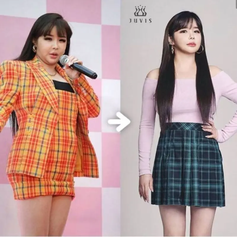 Park Bom dan Banyak Artis Korea Sukses Turunkan Berat Badan Karena Juvis Diet