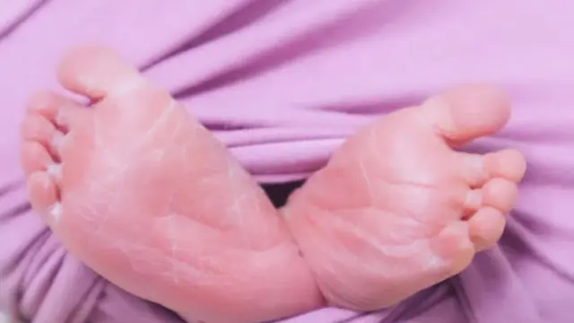 Potret Kaki Anak Indah Indriana (Instagram/@indahindriana)