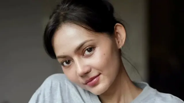 Rina Nose Menjalani Operasi Plastik bersama dokter Tompi. [@dr_tompi]