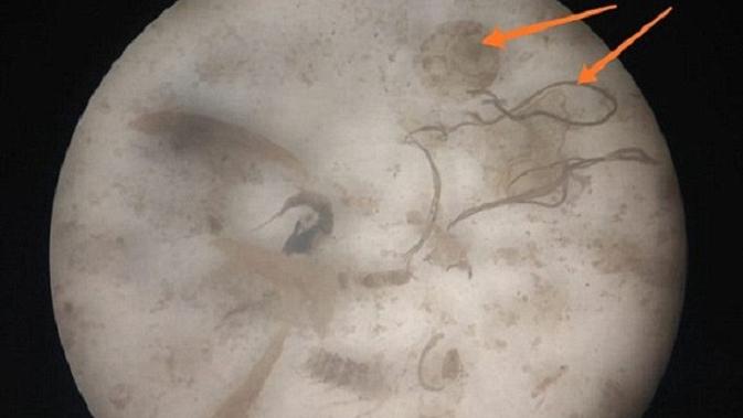 Gambar ini adalah gambar mikroskopis dari perut ikan, dengan serat popok yang disorot. (Ecoton)