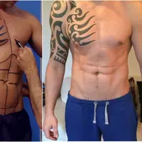 Terobsesi dengan bentuk tubuh seksi, pria ini rela mengeluarkan Rp 71 juta demi operasi abdominal. 