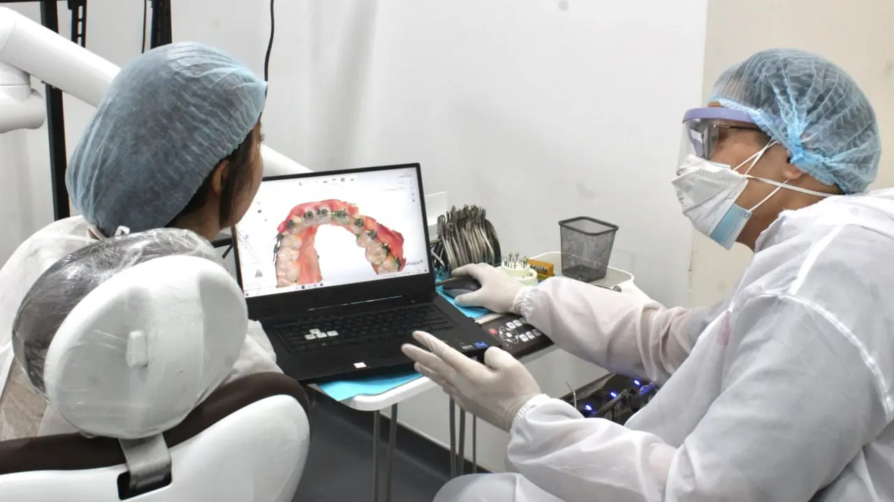 Smiley, clear aligner