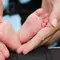 Dermatitis Atopik pada Anak Bukan Sekadar Kulit Kering Biasa