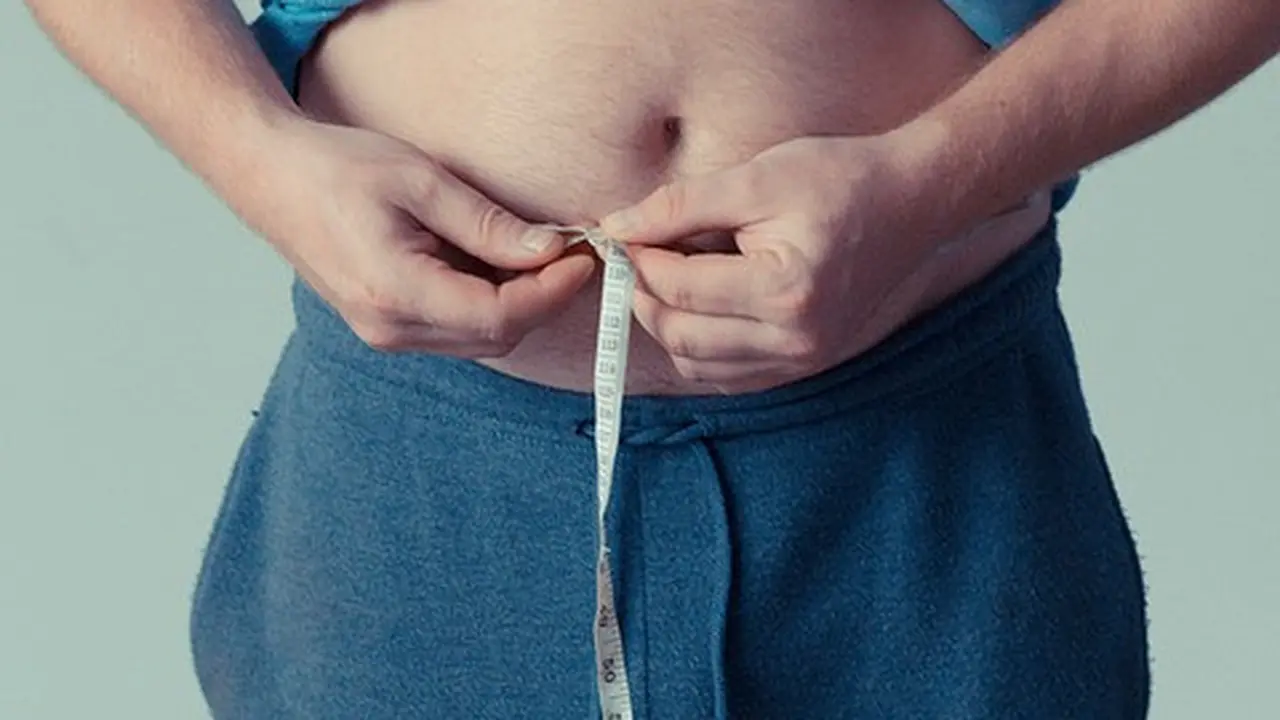 Ilustrasi obesitas.