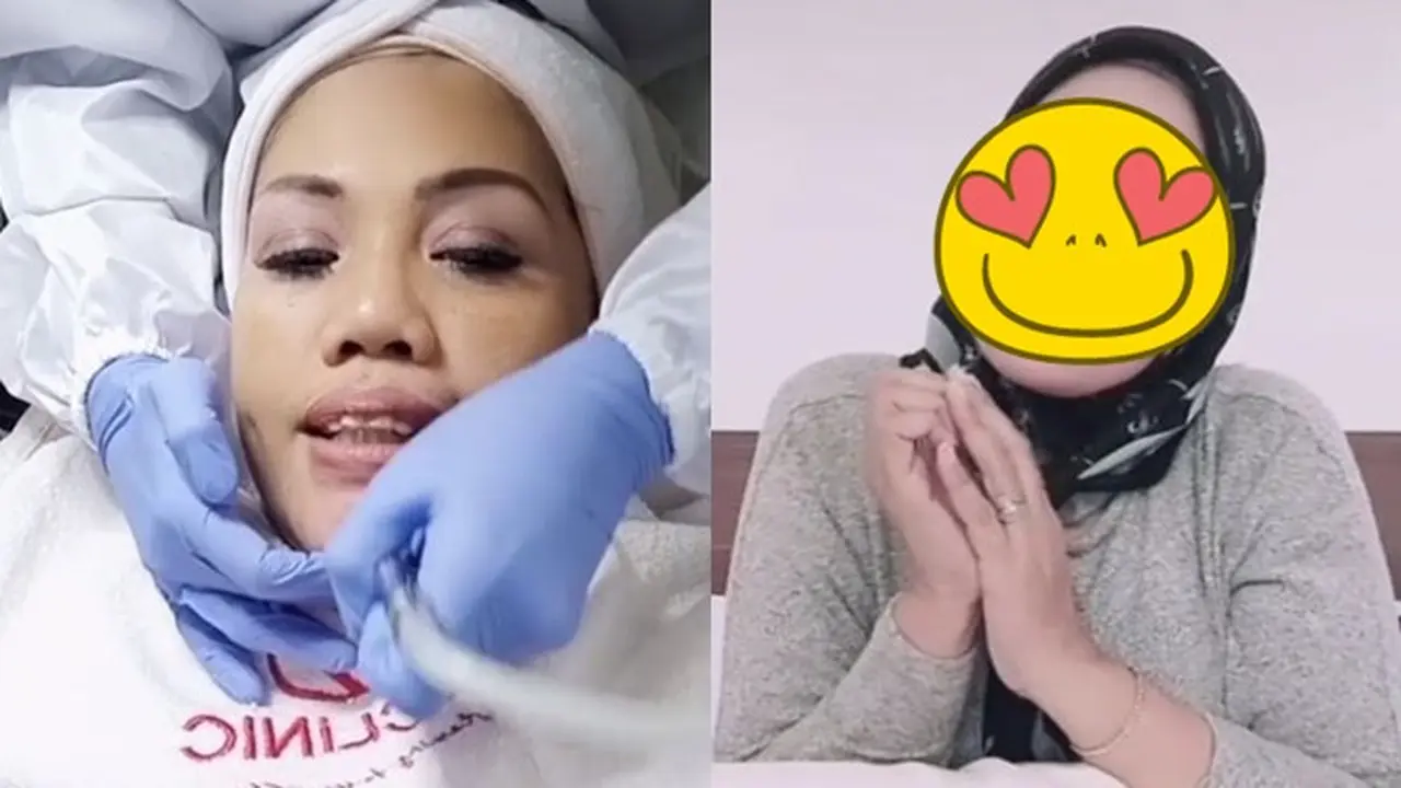 Perawatan Pengencangan Kulit Wajah, Ini 6 Potret Terbaru Elly Sugigi Semakin Tirus