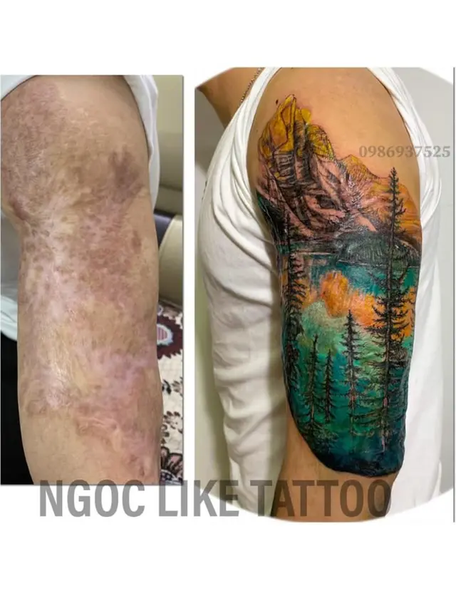 7 Potret Tato Keren Sulap Bekas Luka Jadi Seni Indah