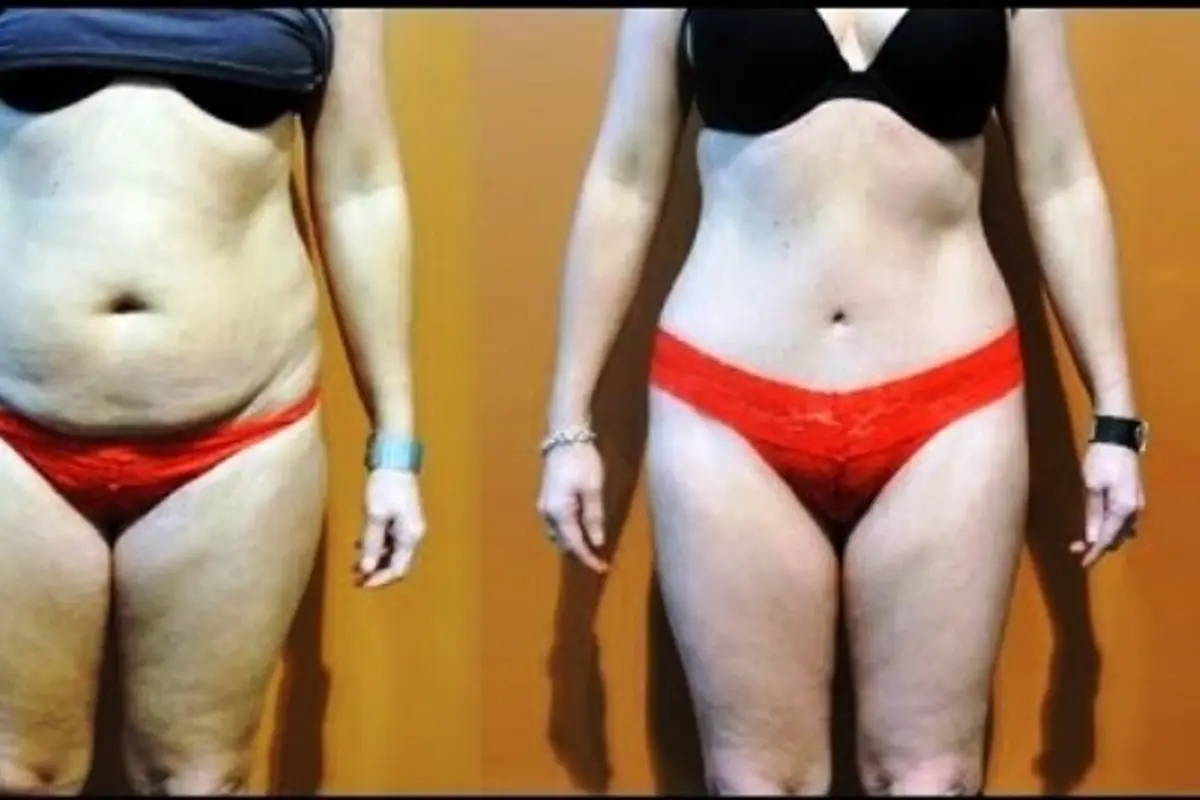 Tanpa Diet Berat Badan Turun 9 Kg dalam 21 Hari, Mau?