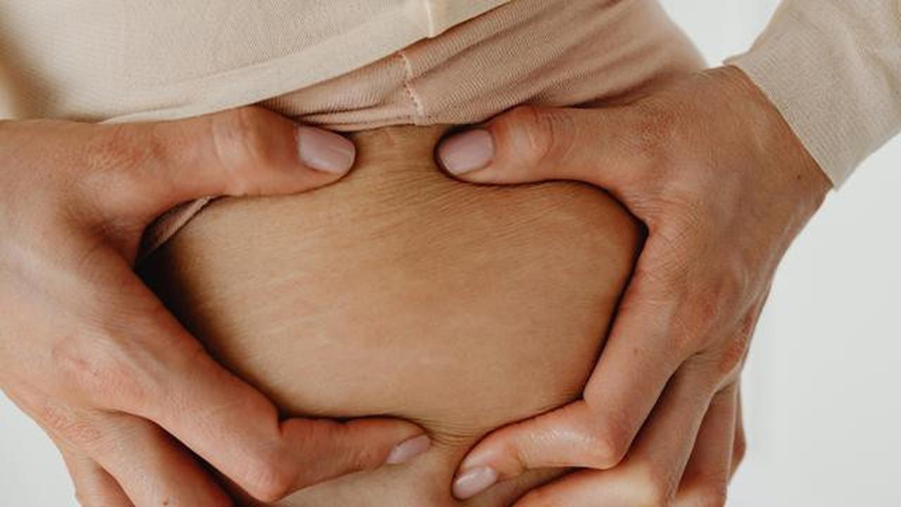 Stretch Mark pada Pria, Fakta, Penyebab dan Cara Pencegahannya