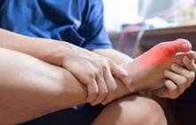 Cara Cepat Atasi Masalah Linu Asam Urat yang Menyerang, Buat Kaki dan tangan Jadi Lega Seketika